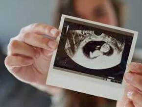 Mujer sosteniendo una imagen por ecografía